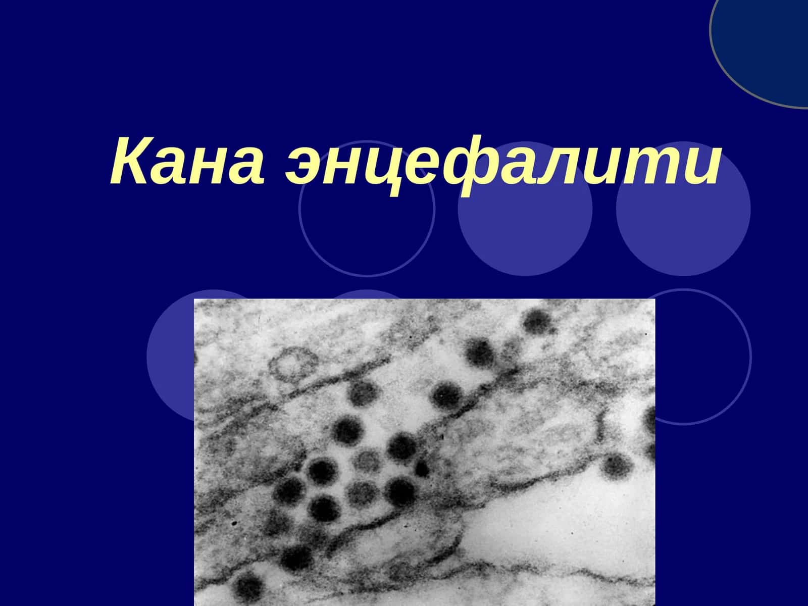 Кана энцефалити 1