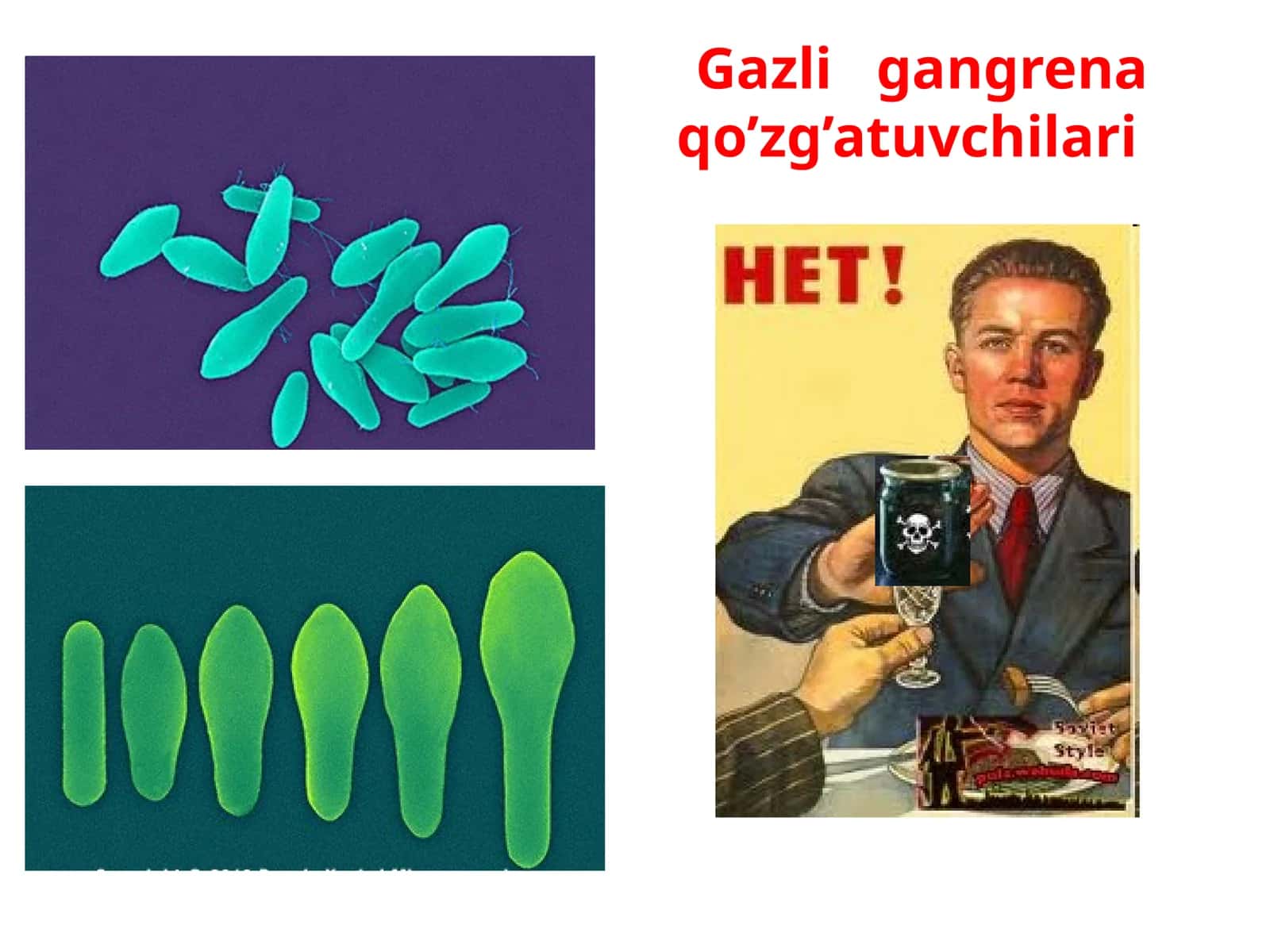 Gazligangrena qo’zg’atuvchilari 1
