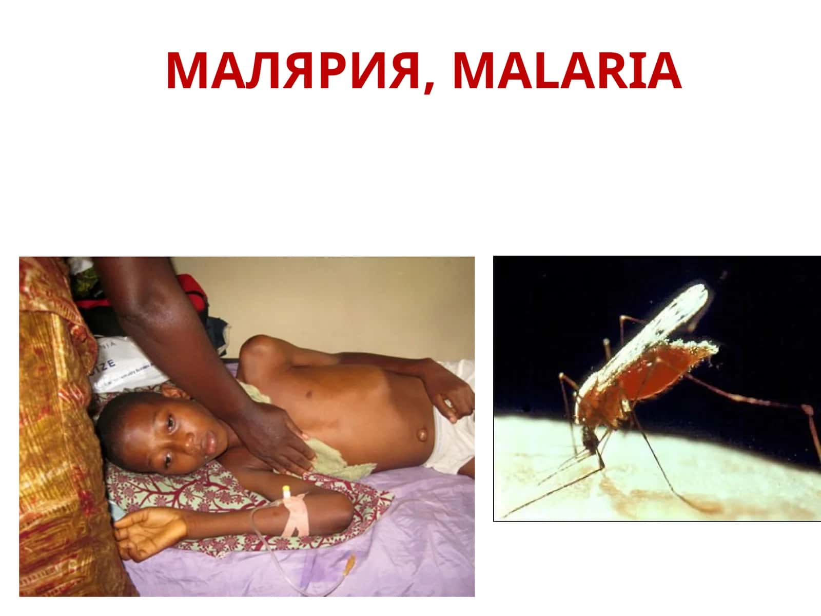 МАЛЯРИЯ 1