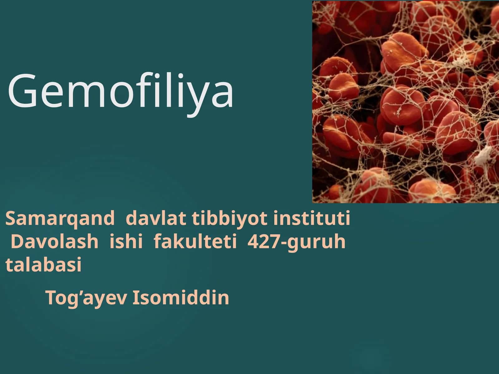 Gemofiliya 1