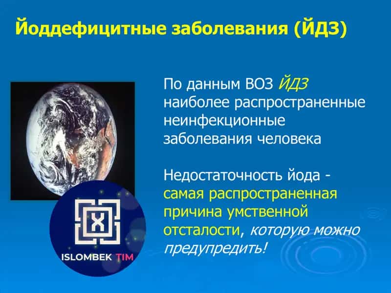 Йод дефицитные заболевания (ЙДЗ) 1