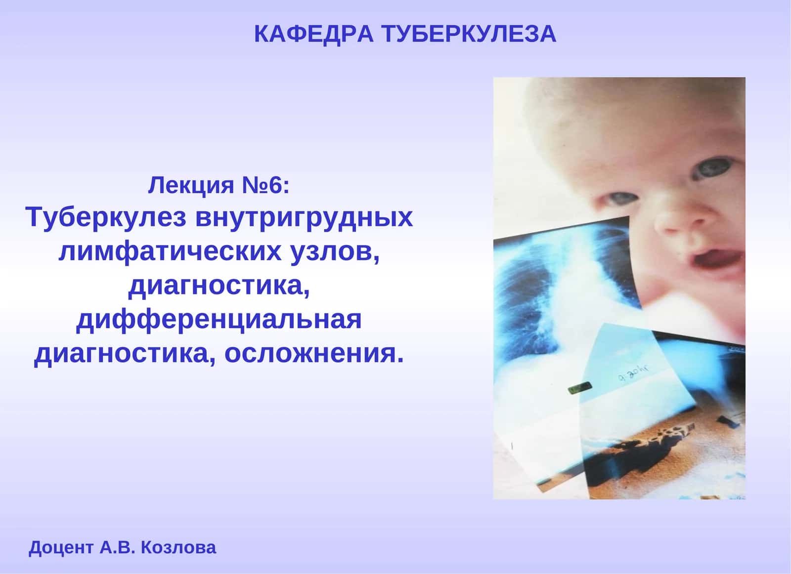 Туберкулез внутригрудных лимфатических узлов 1