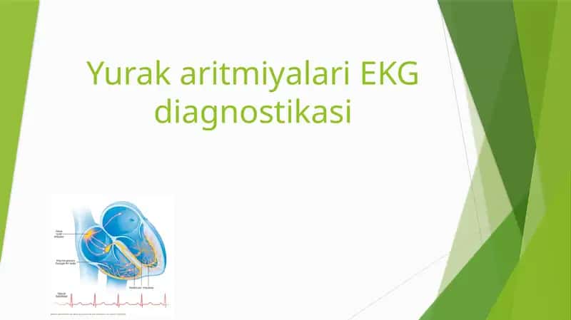 YurakaritmiyalariEKG diagnostikasi 1