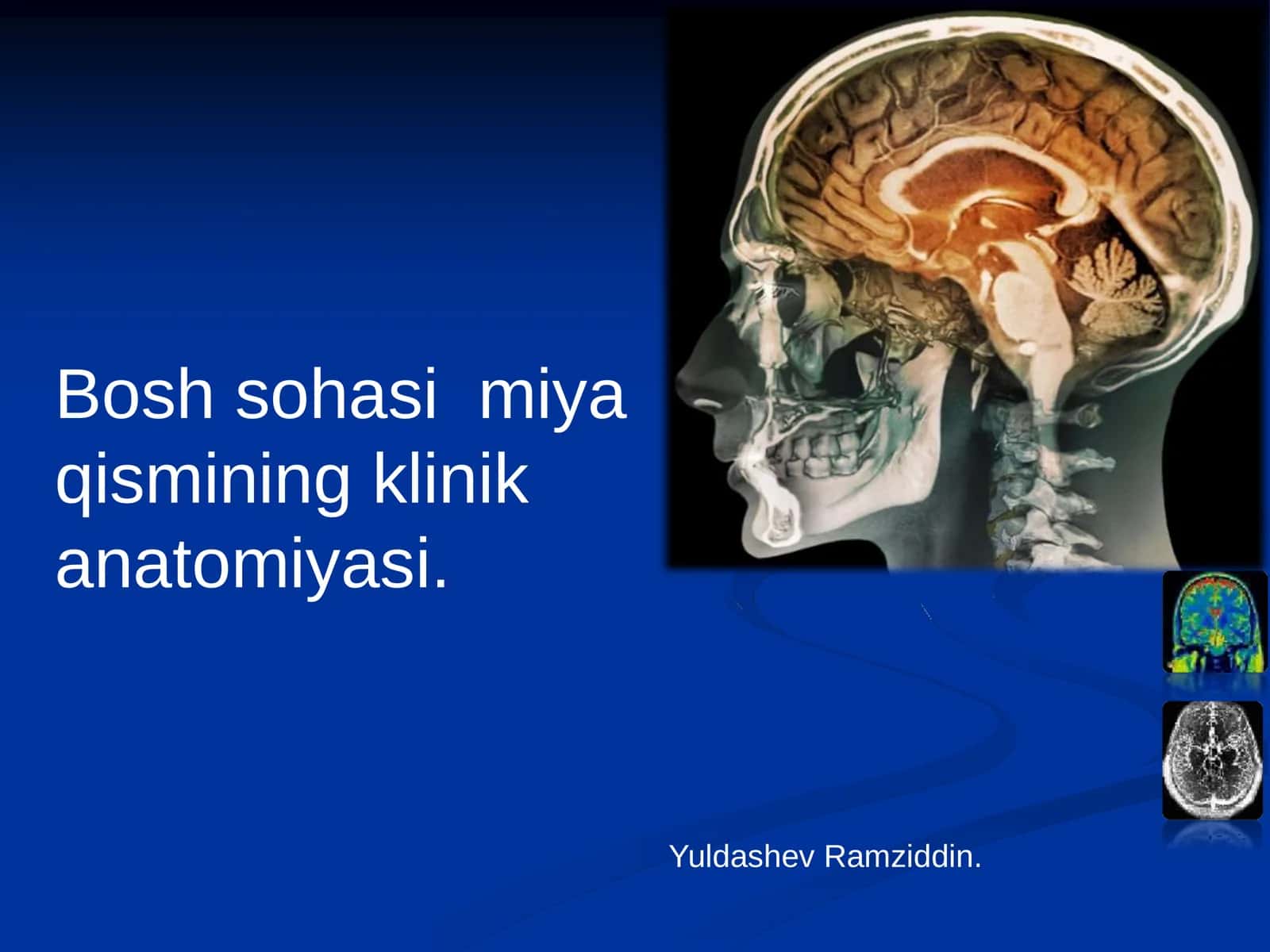 Bosh sohasi miya qismining klinik anatomiyasi 1