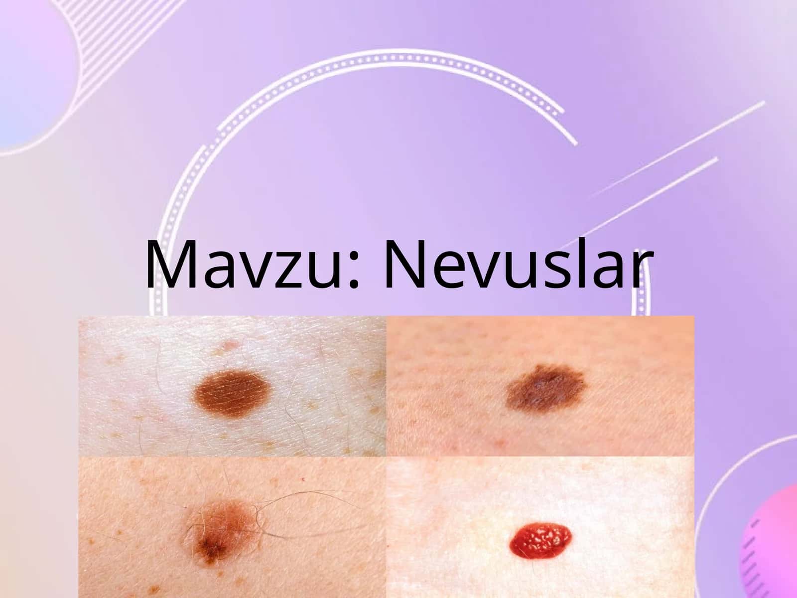 Nevuslar 1