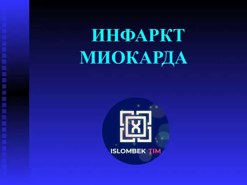 ИНФАРКТ МИОКАРДА 1