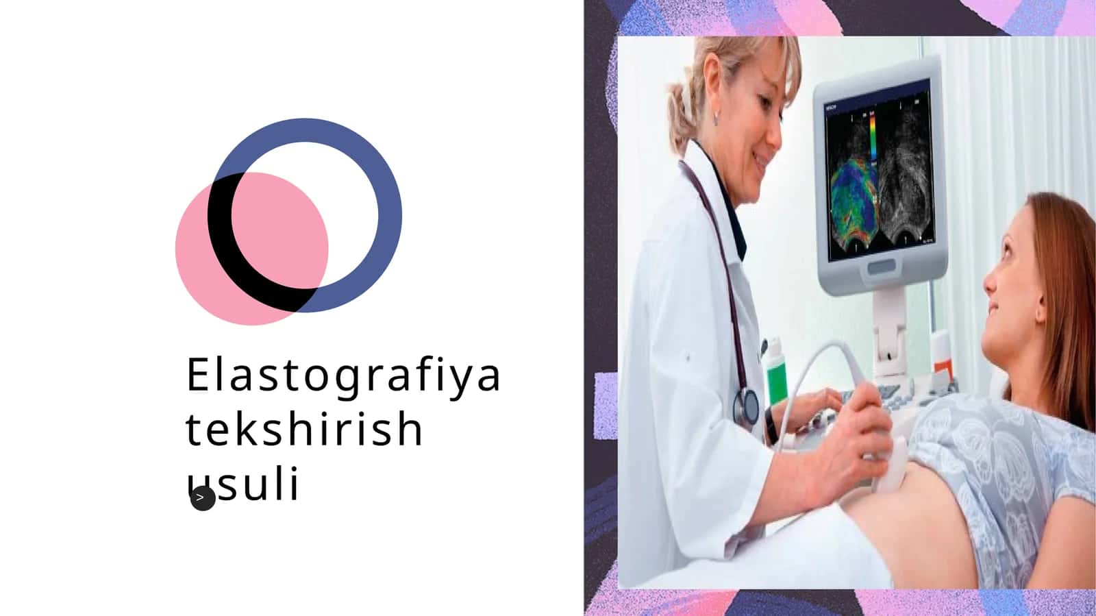 Elastografiya tekshirish usuli 1