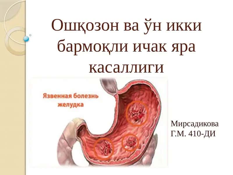Меъда 1