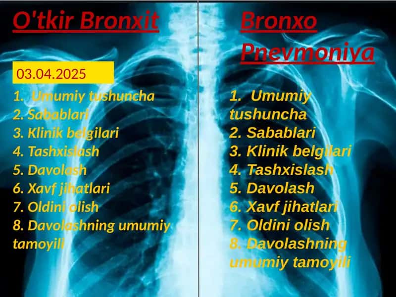O'tkir bronxit 1