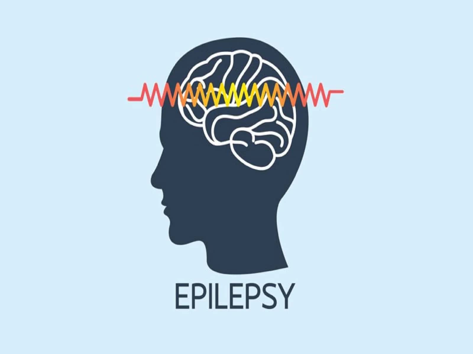 Epilepsiya 1