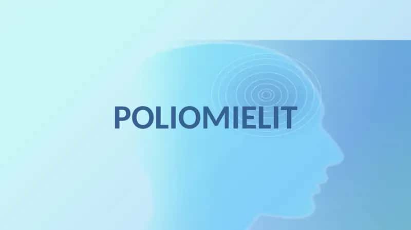 POLIOMIЕLIT 1