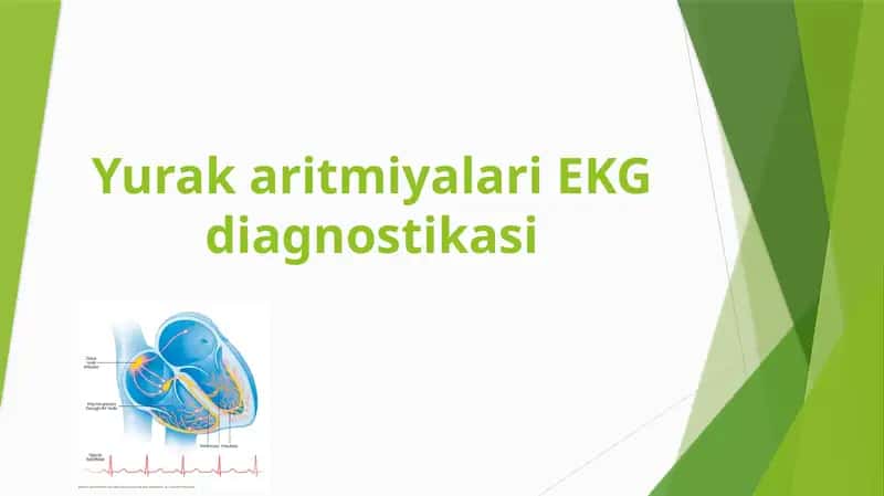 Yurak aritmiyalari EKG diagnostikasi 1