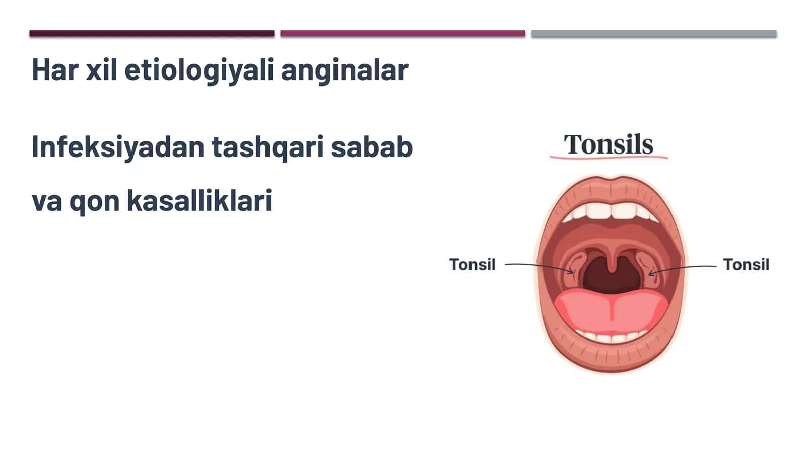 Angina (tonzillit) 1