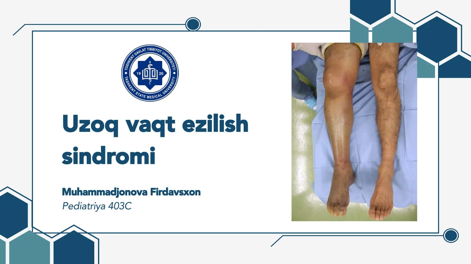 Uzoq vaqt ezilish sindromi 1