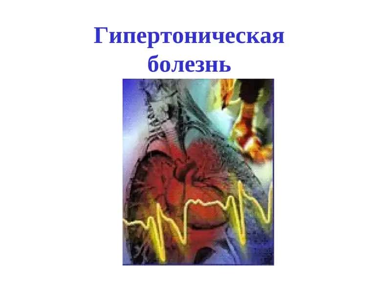 Гипертоническая болезнь 1
