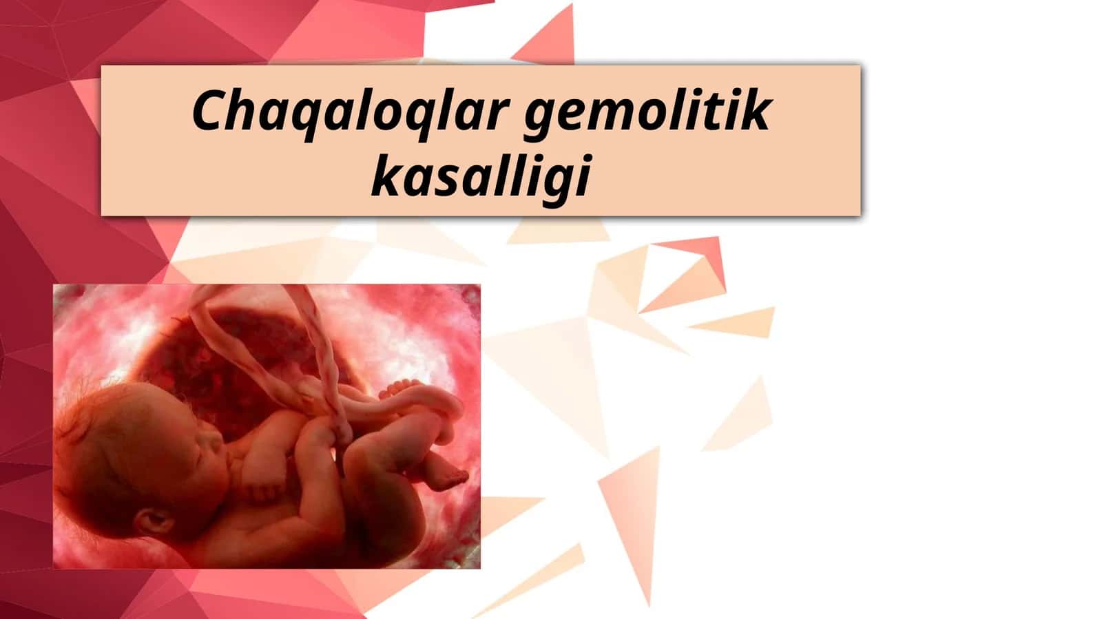Chaqaloqlar gemolitik kasalligi 1