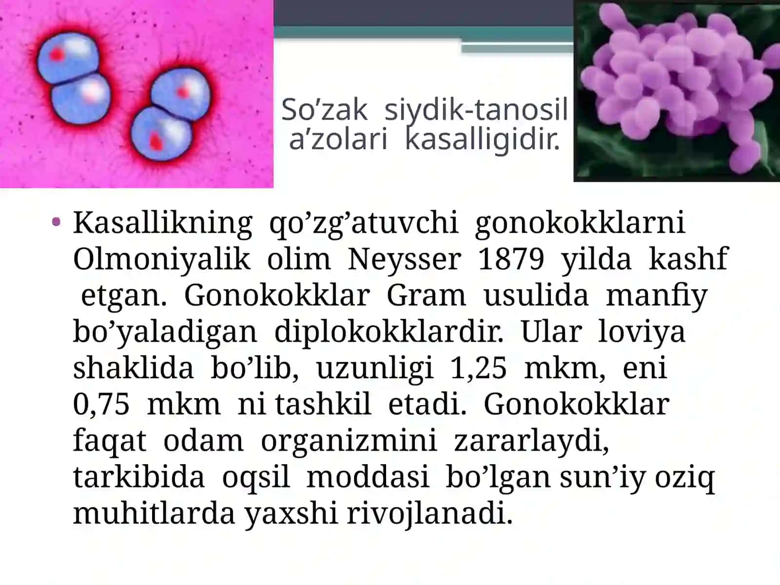 So’zak  siydik-tanosil  a’zolari  kasalligidir. 2