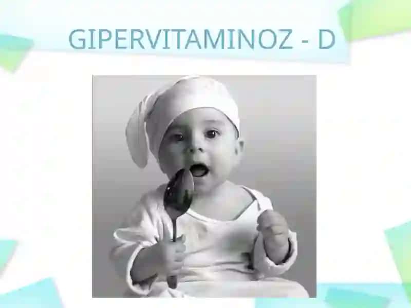 RAXITSIMON KASALLIK GIPERVITAMINOZ- D 2