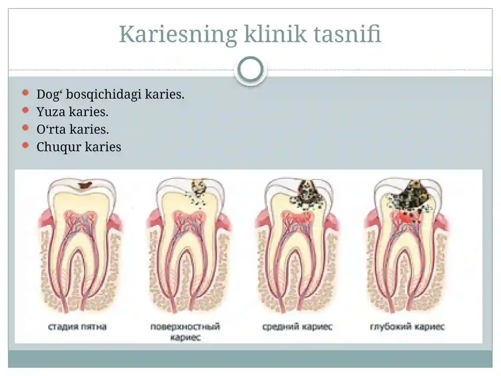 [Chuqur karies] 2