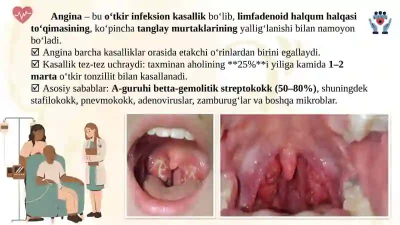 QON KASALLIKLARIDA IKKILAMCHI ANGINALAR 2