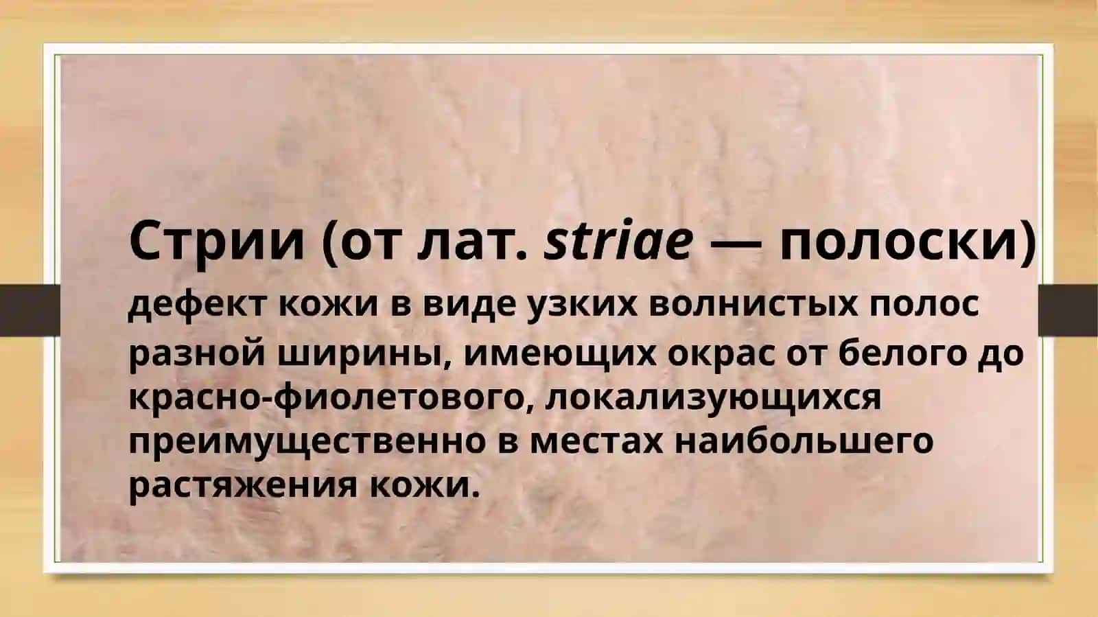Растяжки 2