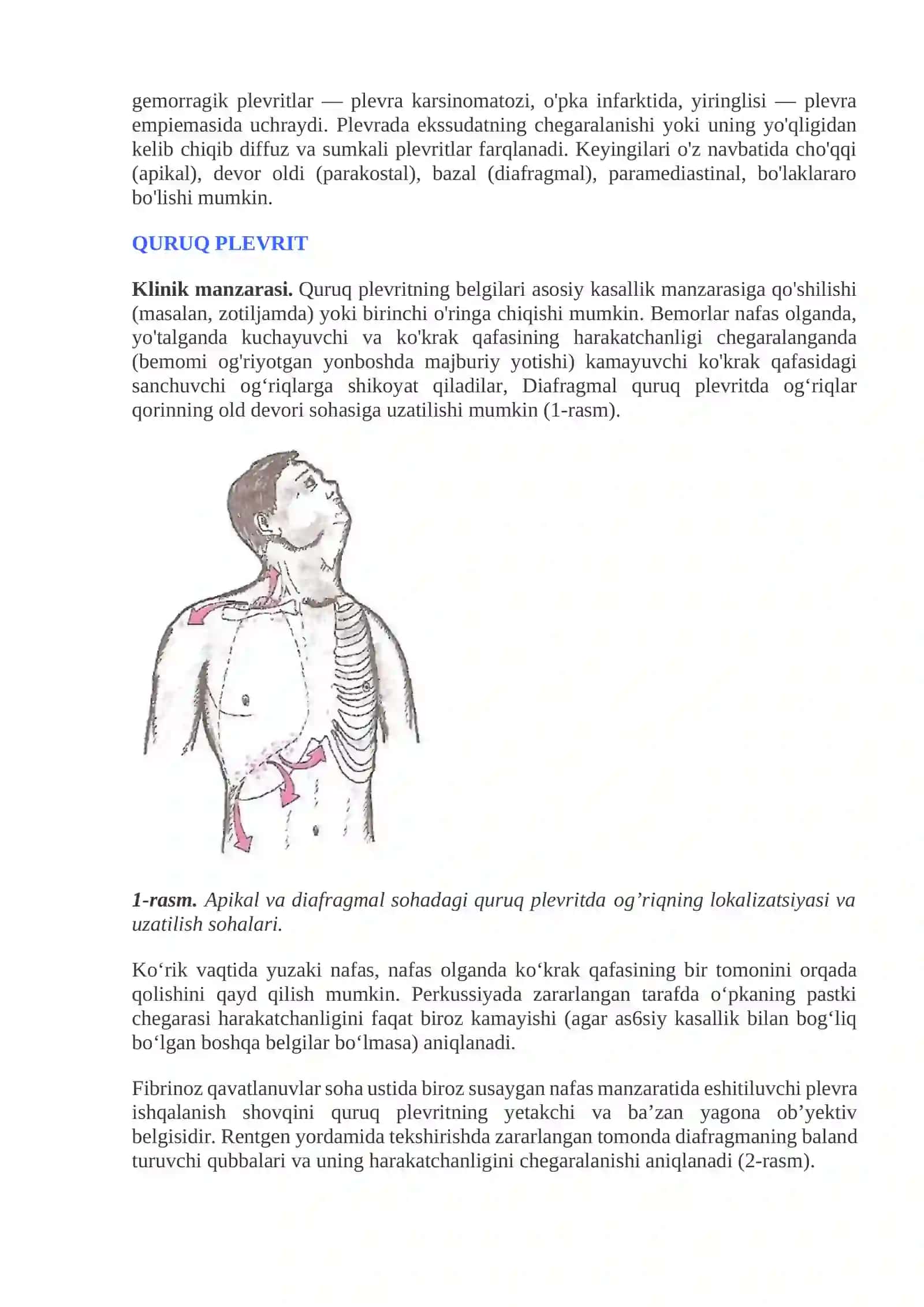 Plevritlar 2
