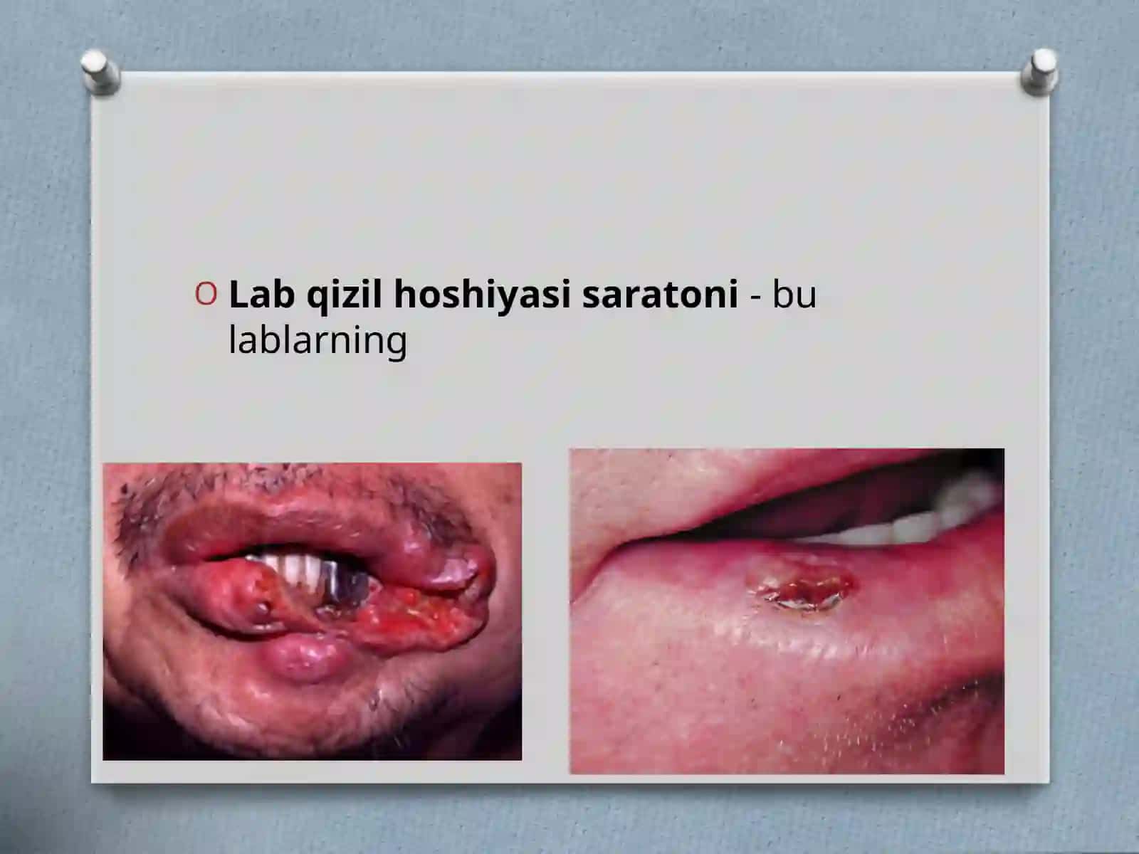 Labqizilhoshiyasisaratoni 2