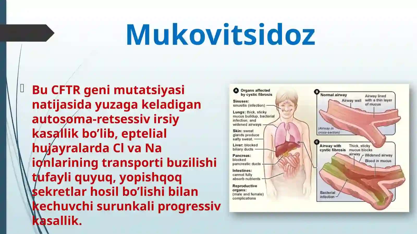 O’pka mukovitsidozi 2