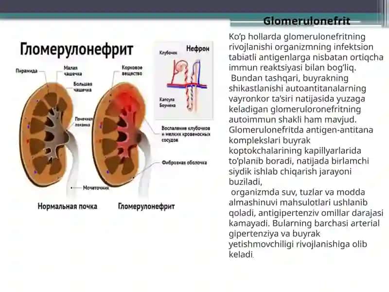 Glomerulonefrit ,
 Endokardit , 
Yarali Kolit. 2