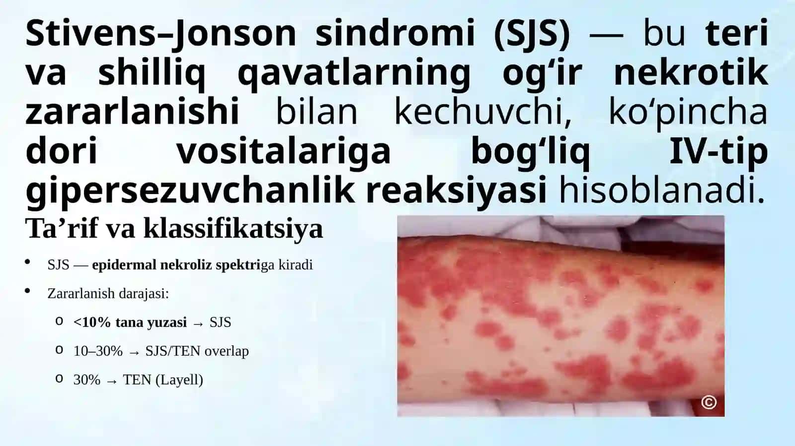 LayellvaStevens-Johnsonsindromi 2