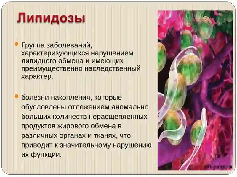 Липидозы 2