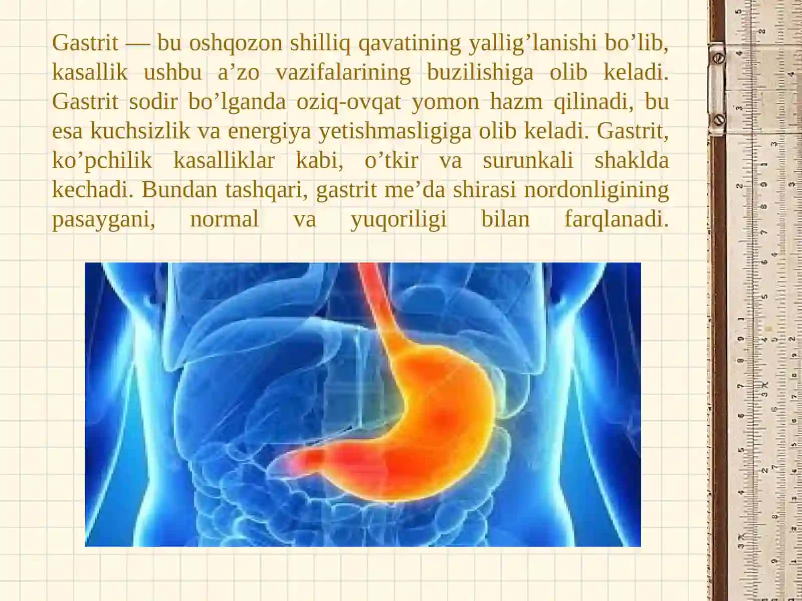 Gastrit 2