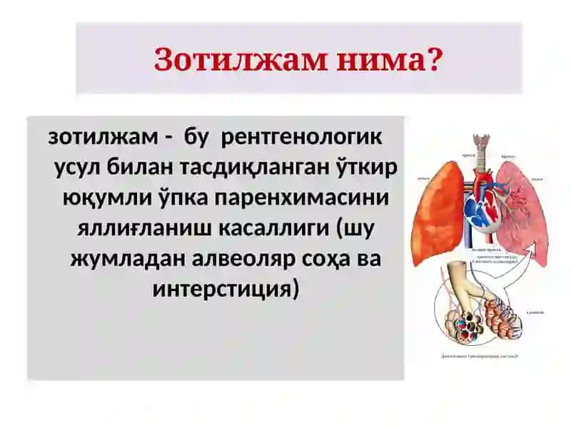 Зотилжам 2