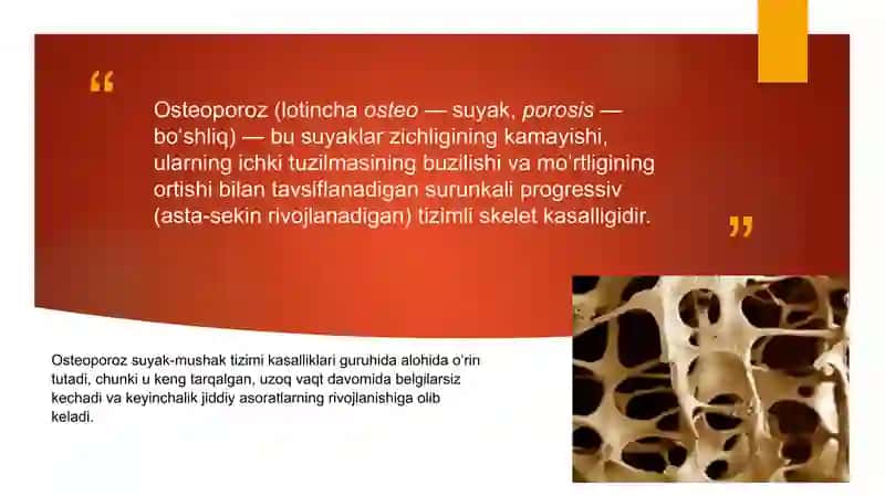 Osteoporoz 2
