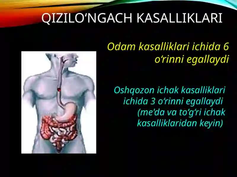 Qizilo‘ngach kasalliklari 2