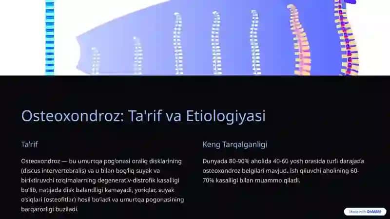 Umurtqalar Osteoxondrozi 2