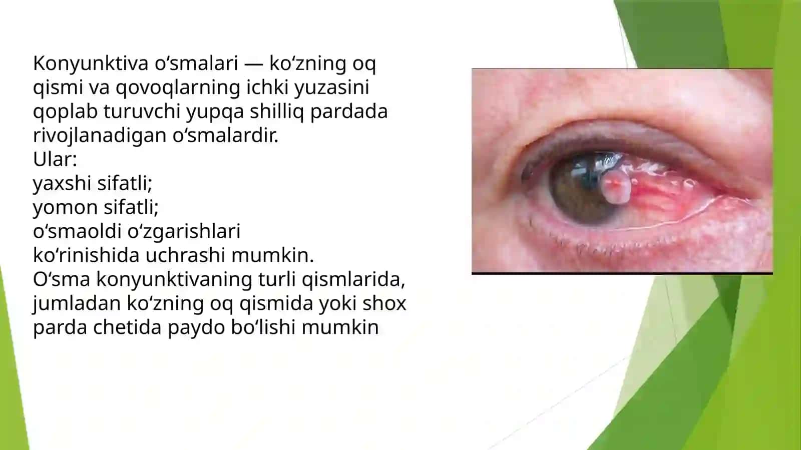 KONYUKTIVA O’SMALARI 2