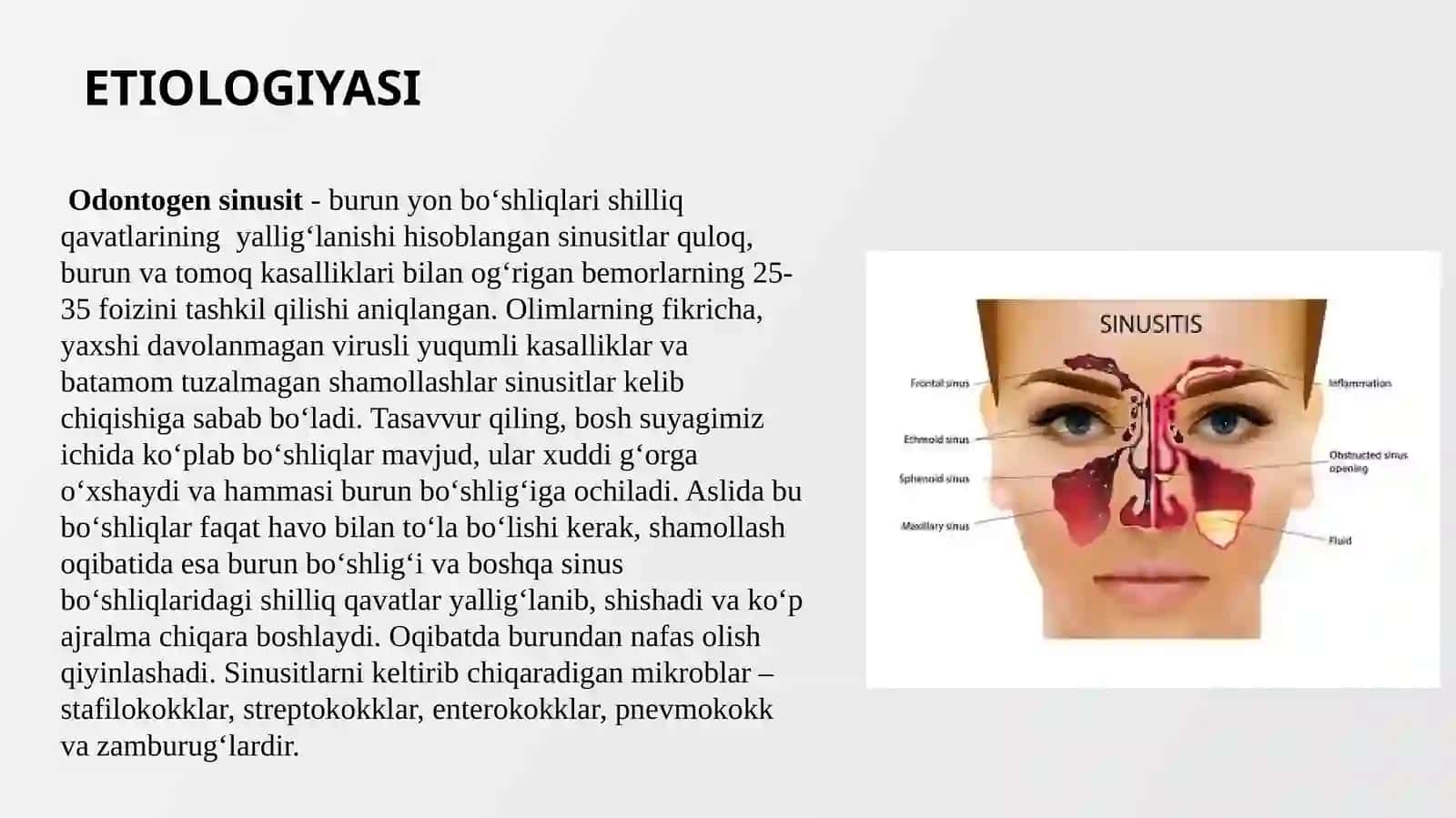 Odontogen sinusit 2