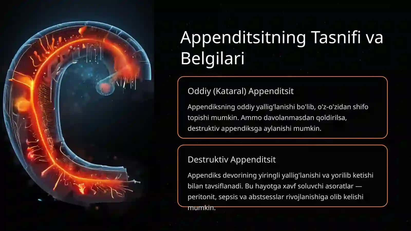 Appenditsit — Xavfli va Keng Tarqalgan Kasallik 2