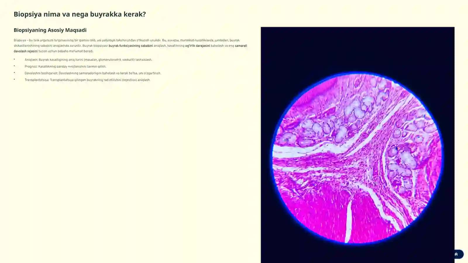 Buyrak Biopsiyasi 2