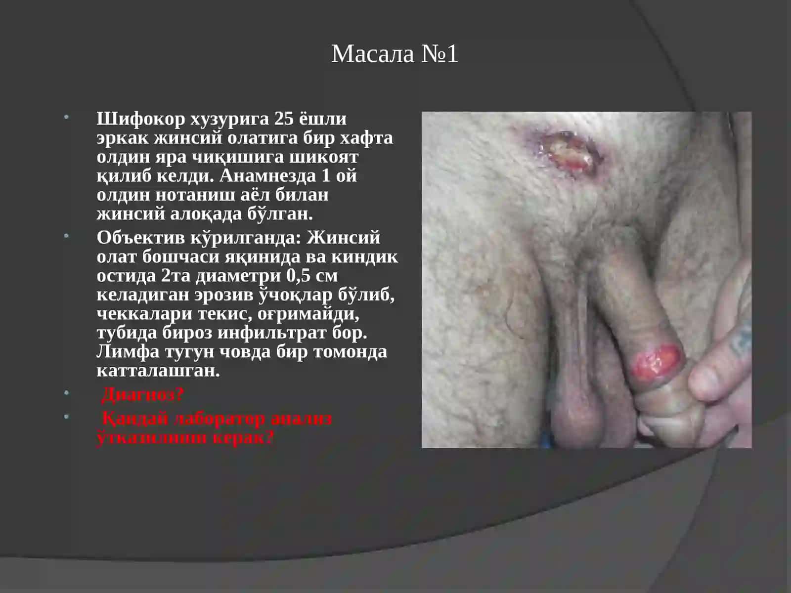 Масала №1 2