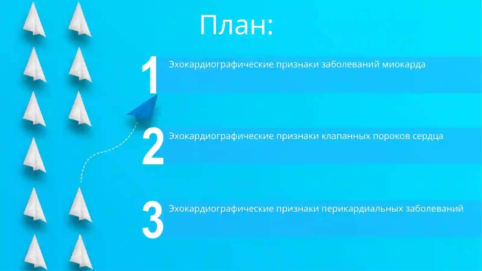 Эхокардиография 2