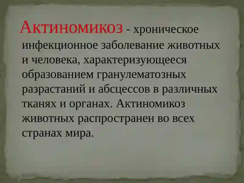 Актиномикоз 2