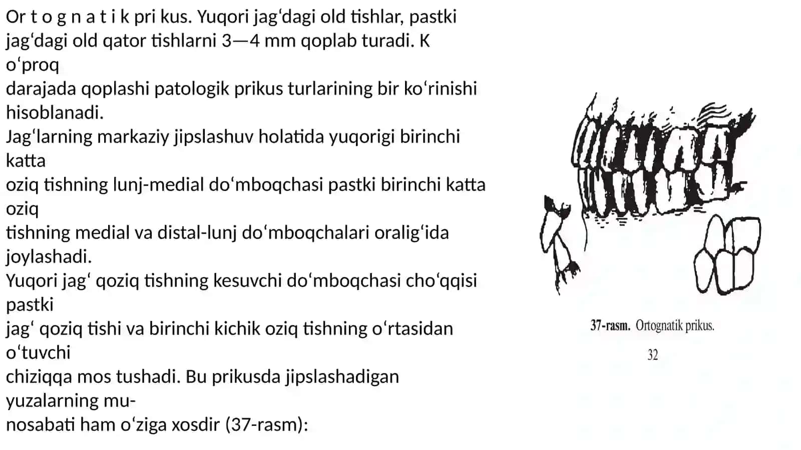 Tish prikuslari 2