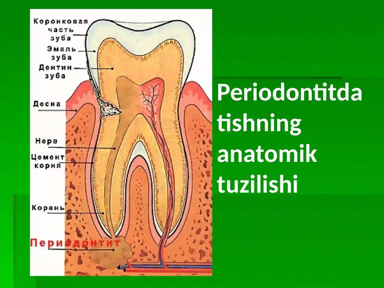 Periodontit 2