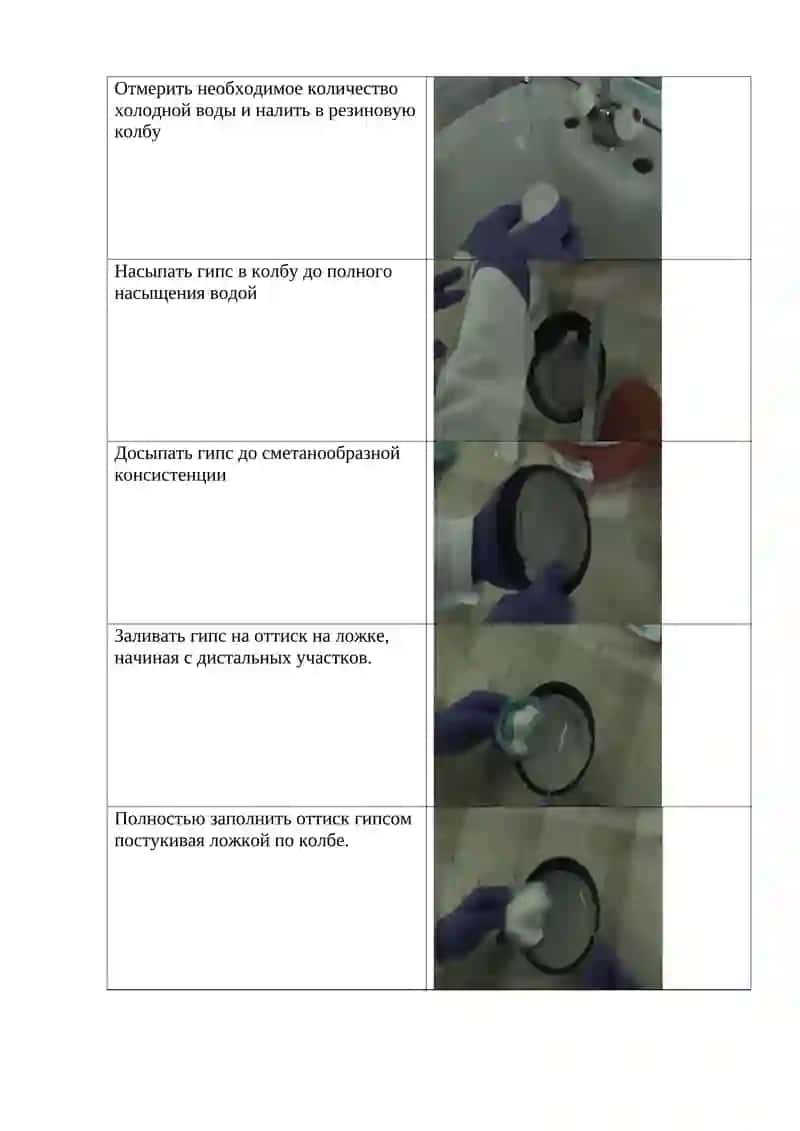 Снятие оттиска эластичной массой 2