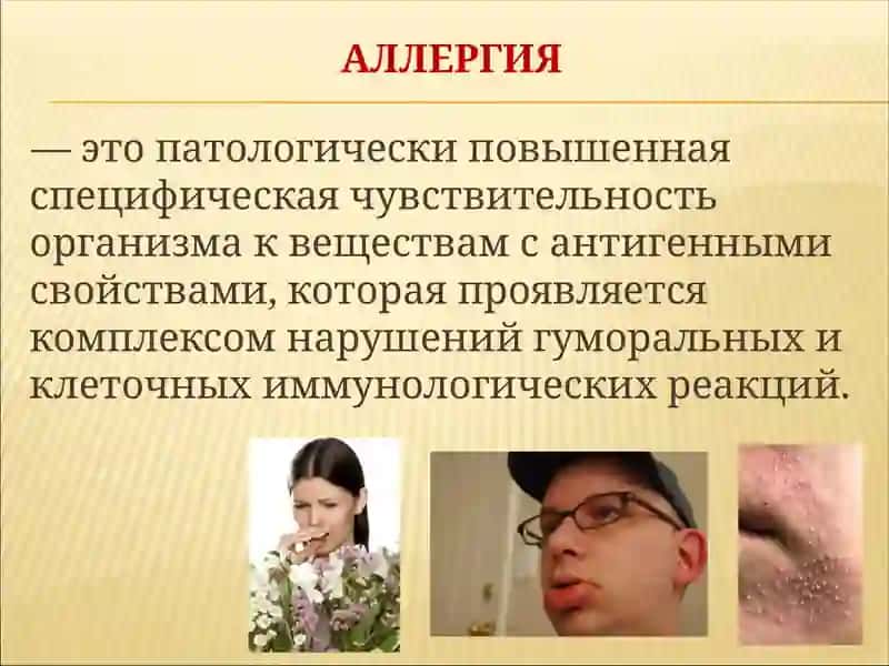 АЛЛЕРГИЯ 2