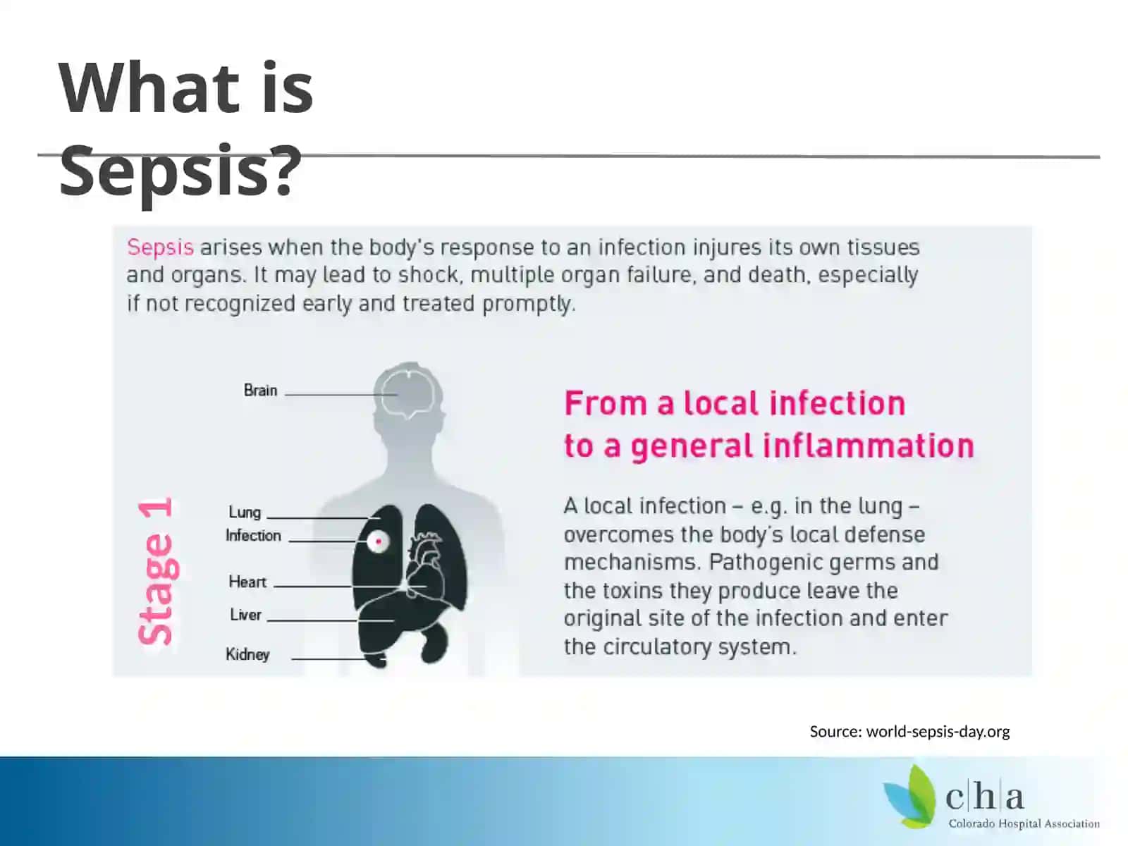 Sepsis 101 2