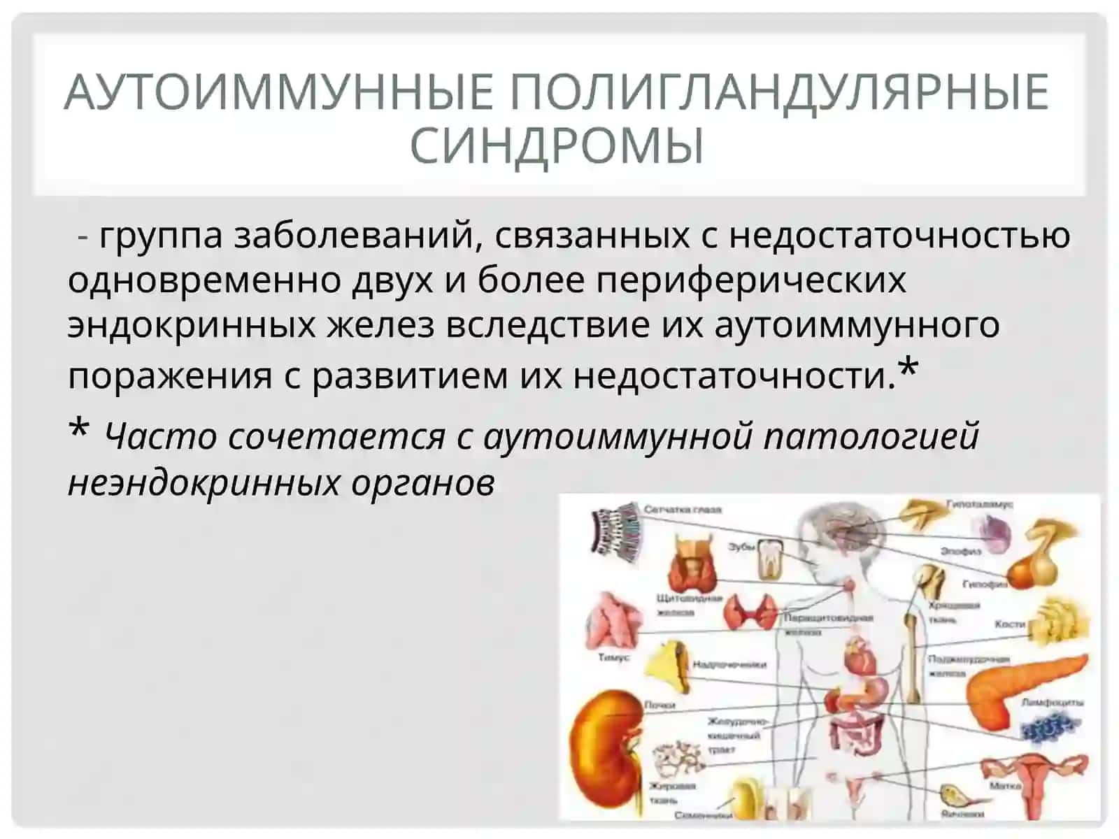 Аутоиммунныеполигландулярныесиндромы 2