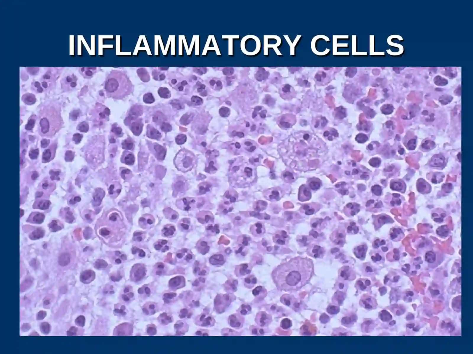 INFLAMMATION AND REPAIR 2